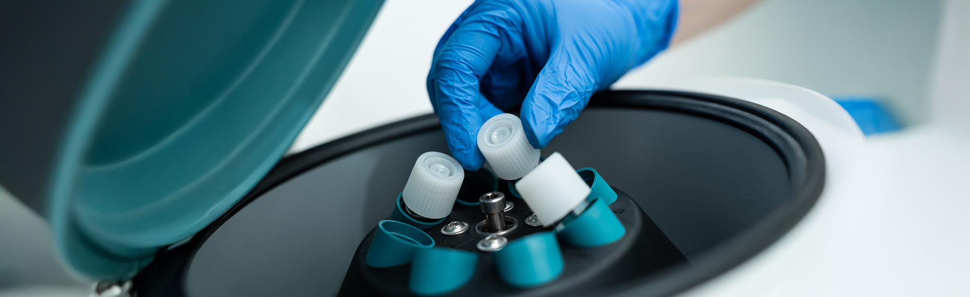 Fertility Preservation