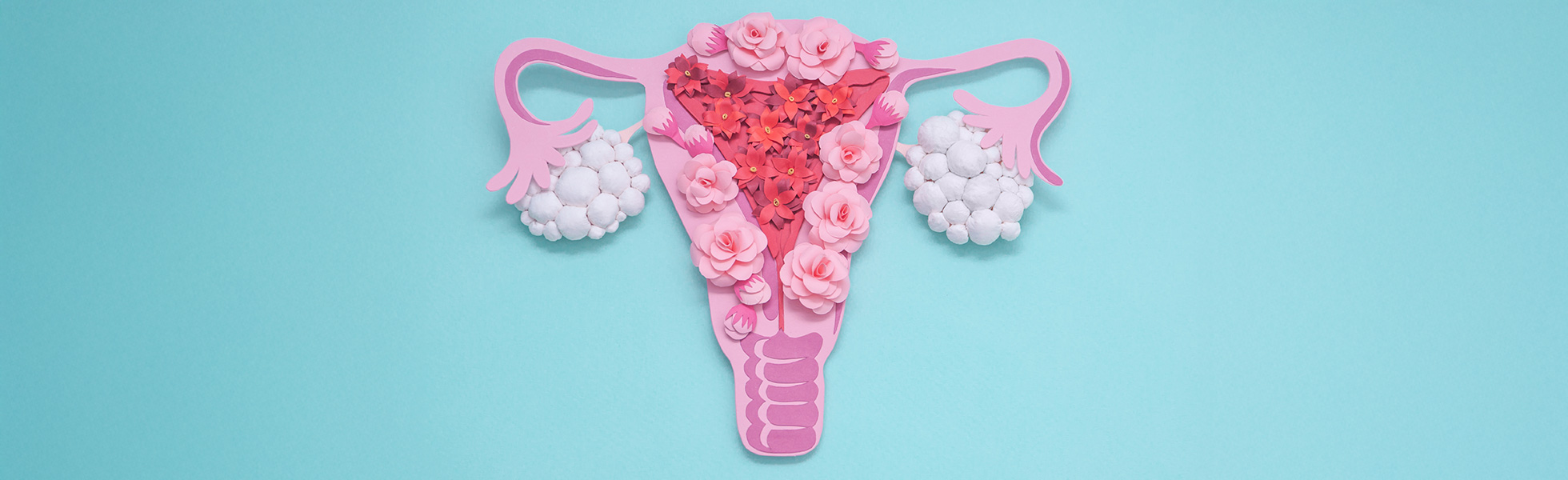 PMOS (PCOS)