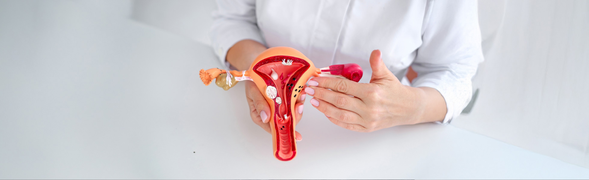 Uterine Fibroids